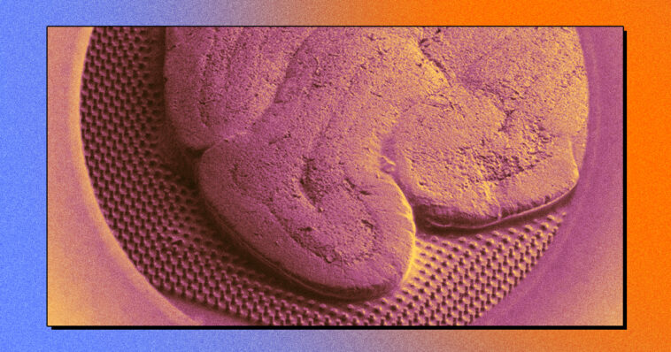 scientists-are-weaving-human-brain-cells-into-microchips