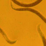 worms,-humans,-brain-damage:-how-do-they-connect?