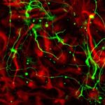 people-with-depression-have-a-loss-of-star-shaped-brain&hellip;