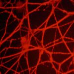 could-a-worm-with-no-brain-help-us-reverse&hellip;