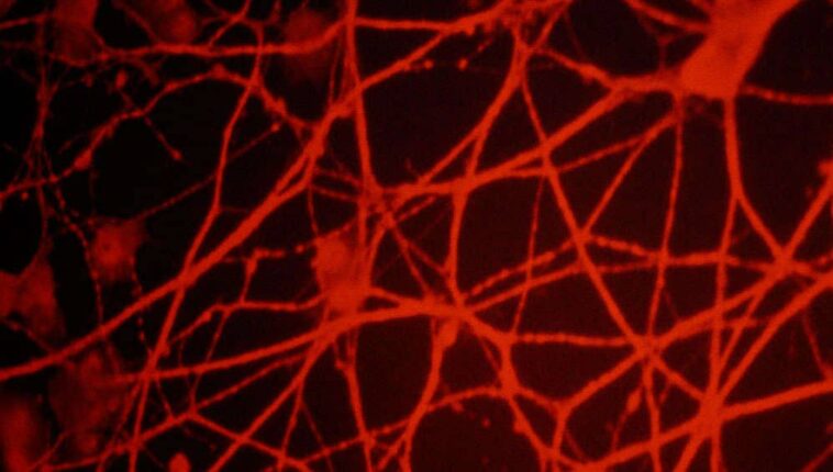 could-a-worm-with-no-brain-help-us-reverse&hellip;