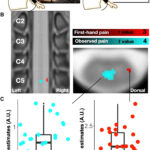 observation-of-others’-painful-heat-stimulation-involves-responses-in&hellip;