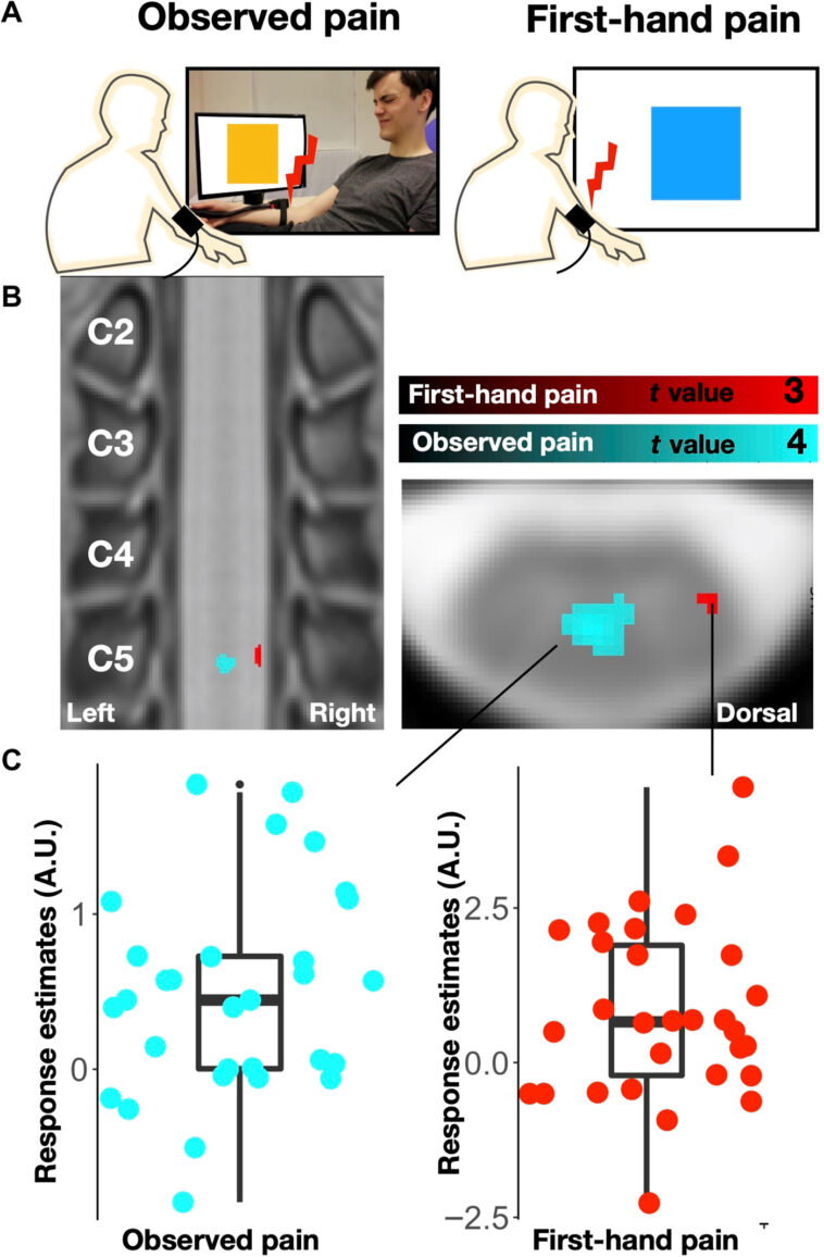 observation-of-others’-painful-heat-stimulation-involves-responses-in&hellip;